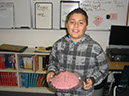 Anthony